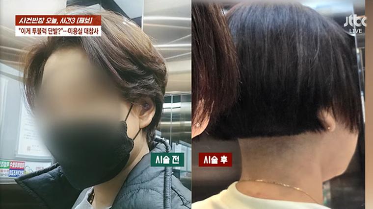 40대女 뒷머리 바리캉으로 멀어버린