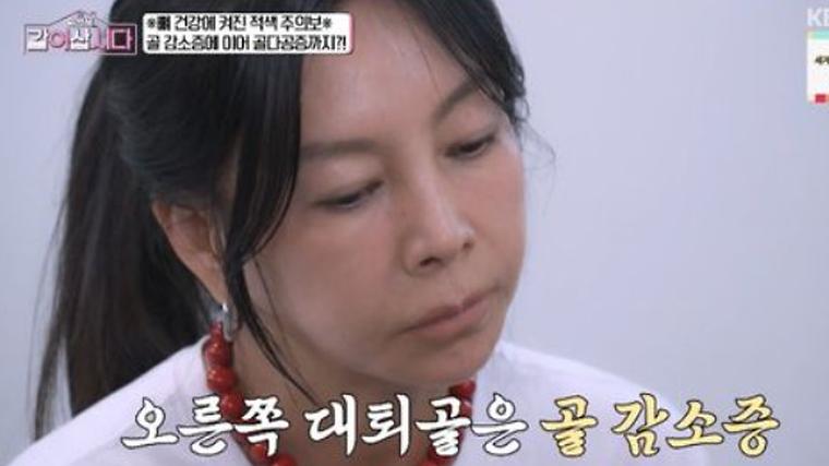 황신혜. 골밀도 검사 충격적인 결과