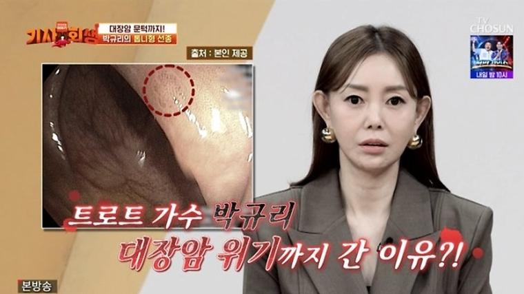 뇌출혈 겪은 트로트 女가수, 매년 