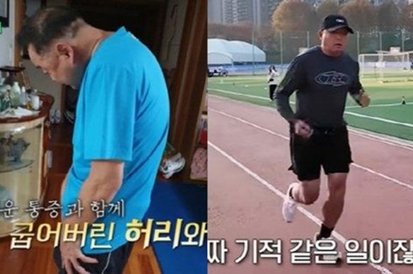 '등 굽었던' 이봉주 맞나…'난치병
