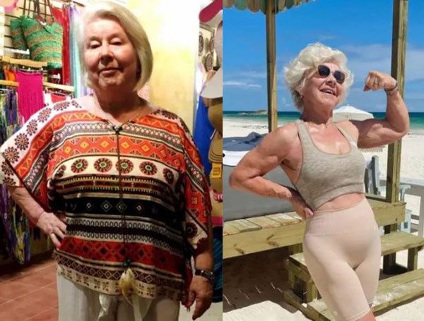 79세 할머니, 30kg 감량에 '