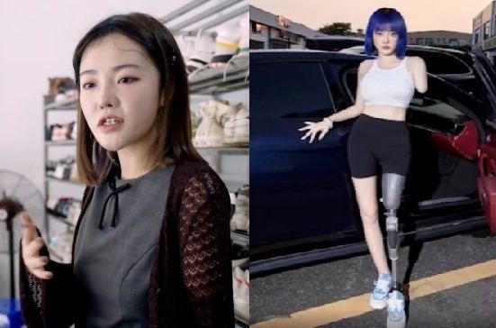 왼쪽 팔다리 잃은 30대女 대박 난
