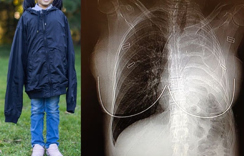 아빠 외투 입고 놀았는데...20년