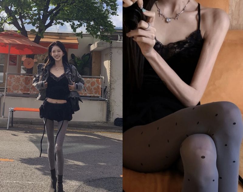 최준희, 살가죽만 남은 '극세사' 팔 자랑