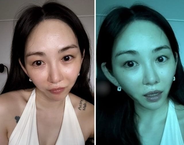 의료사고 후 근황 공개한 권민아, 