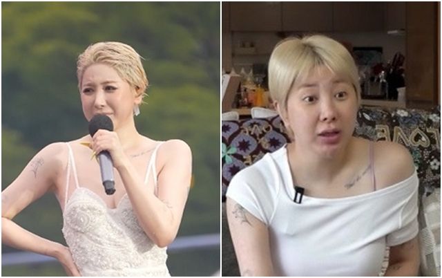 '지방흡입' 서인영 반전 후기, 병