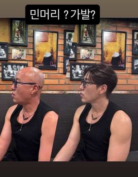 홍석천, 민머리 탈출하나…풍성한 머