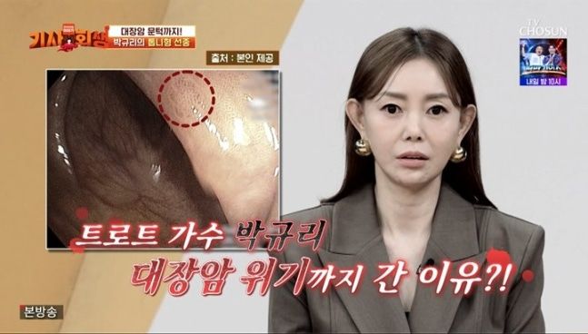 뇌출혈 겪은 트로트 女가수, 매년 