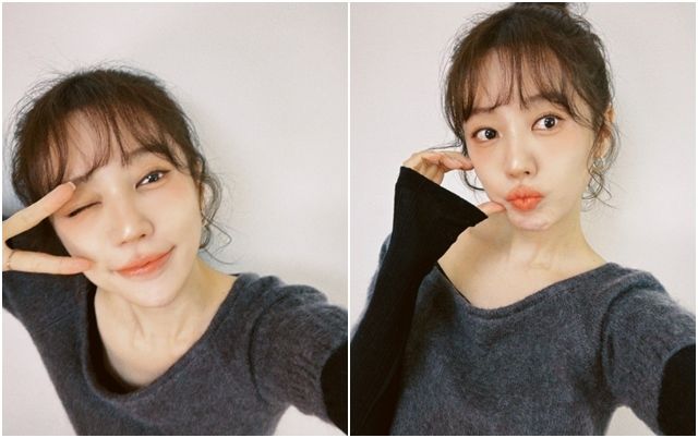 윤은혜, 알레르기 겪은 뒤 근황 